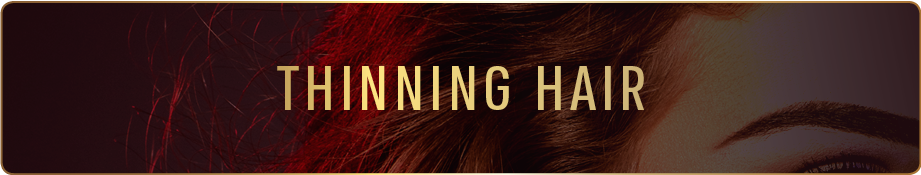 Thinning Hair